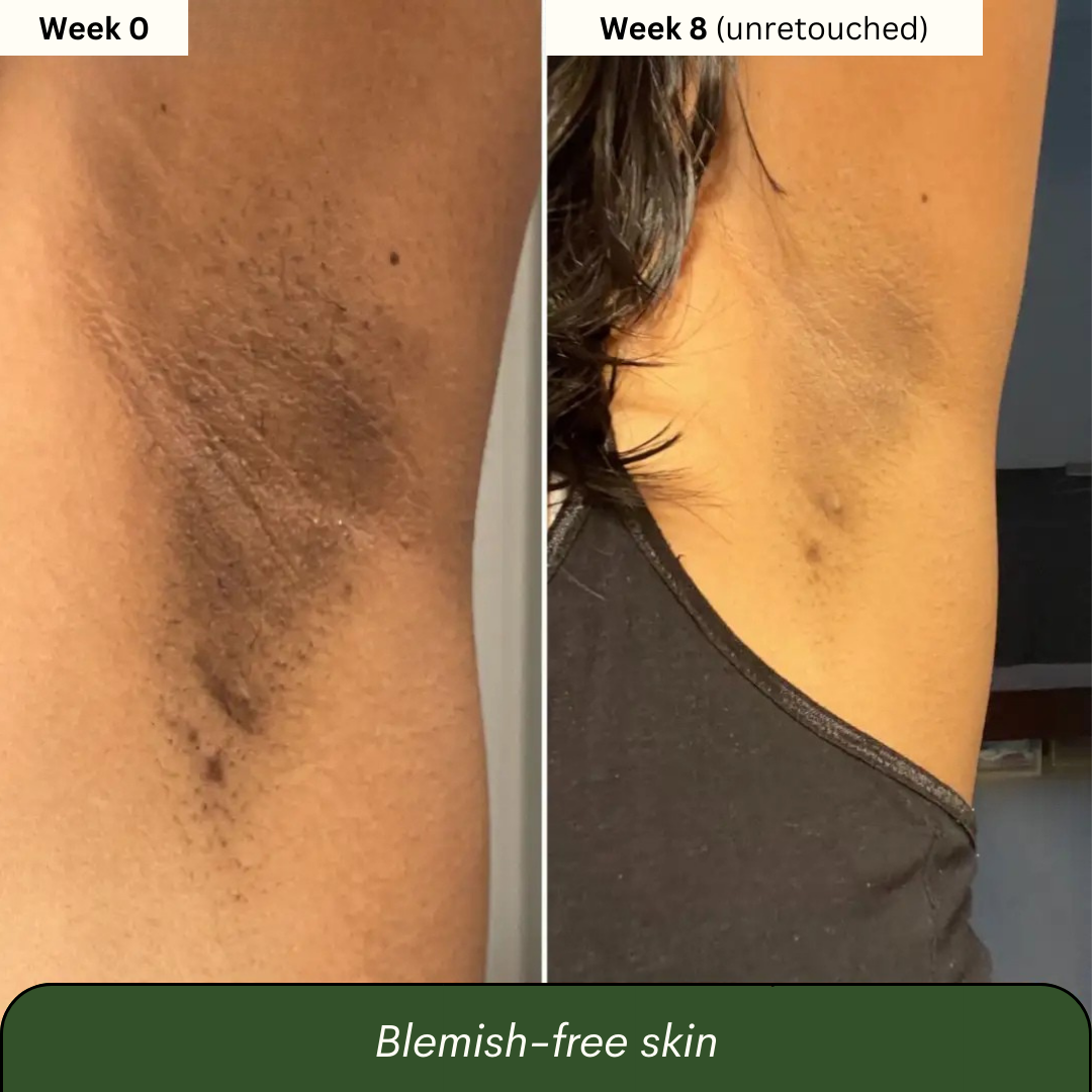 Toning Polish Pads - Korean Skincare for Dark Spots, Wrinkles & Dull Skin