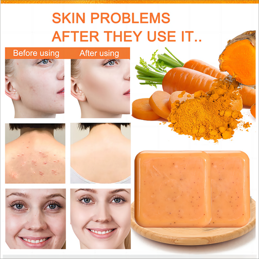 Wild Carrot Kojic Acid Scrub Soap (2 Pack)