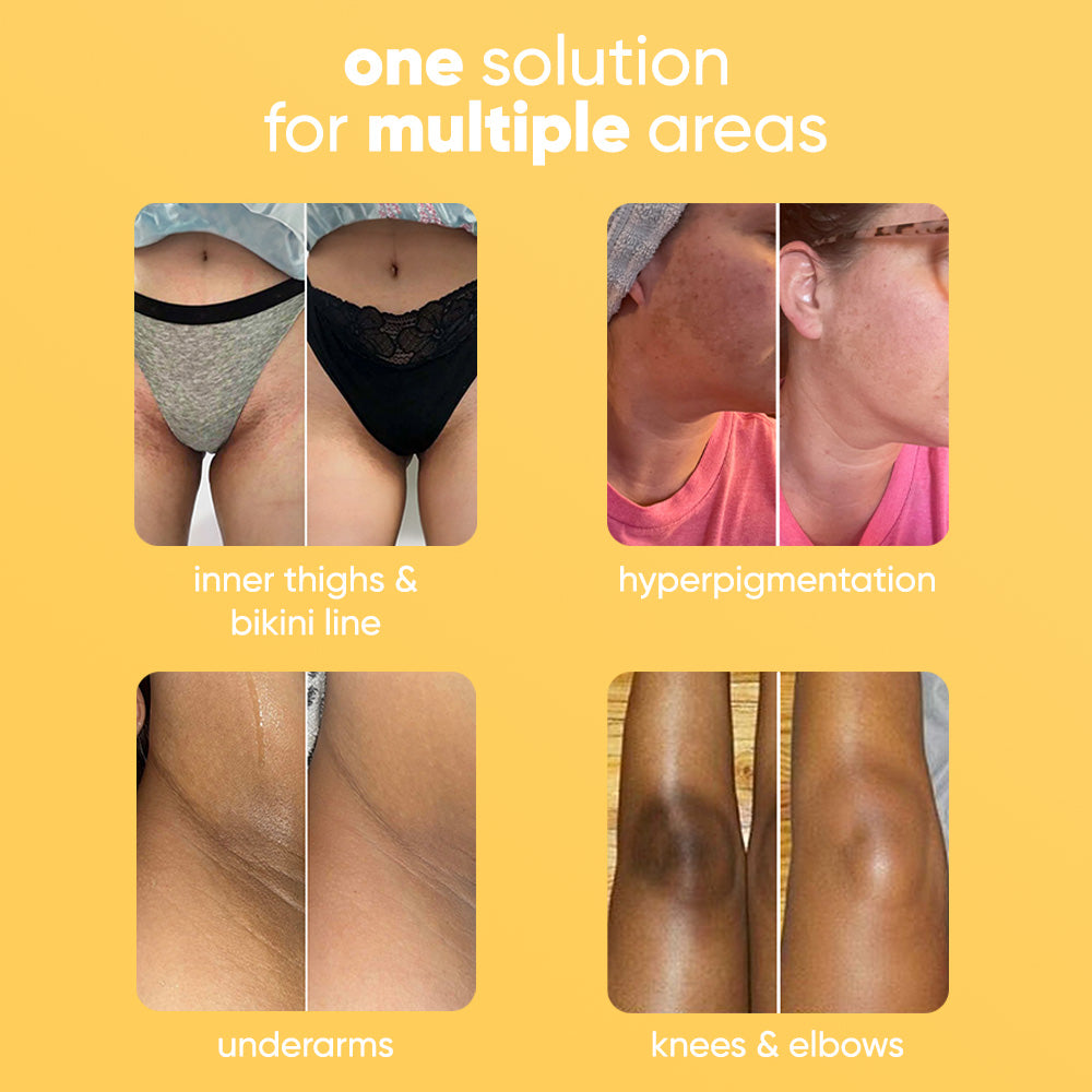 Turmeric Lemon Kojic Acid Soap