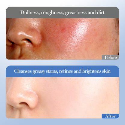 White Rice Niacinamide Moisturizing Gift Set