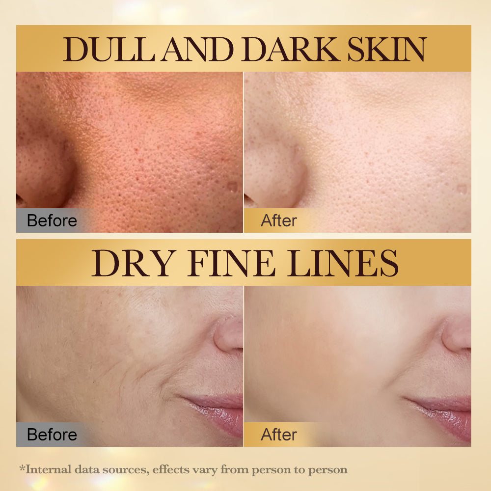 Bee Venom Anti-Wrinkle Firming Facial Cream