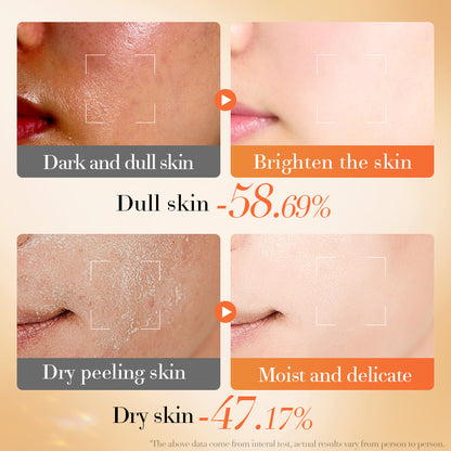 Turmeric VC Daily Hydrating Cream