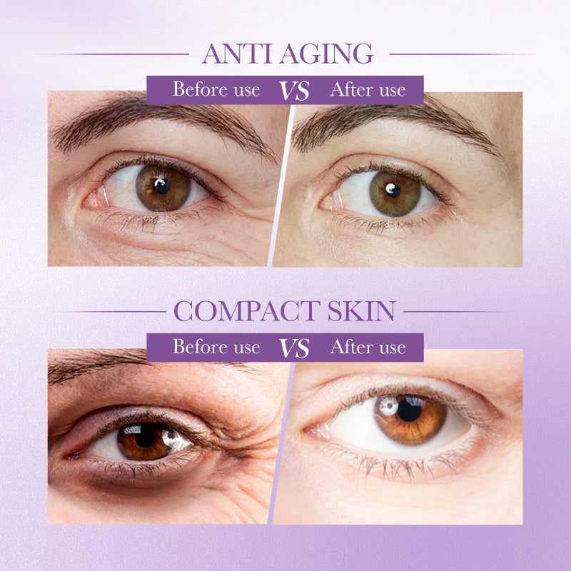 3X Retinol Anti-Aging Eye Cream