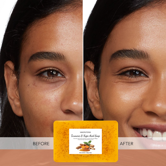 Lemon Turmeric & Kojic Acid Brightening Soap (Gift Set)