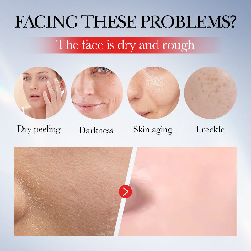 Kojic Acid Whitening and Anti-freckle Facial Cream