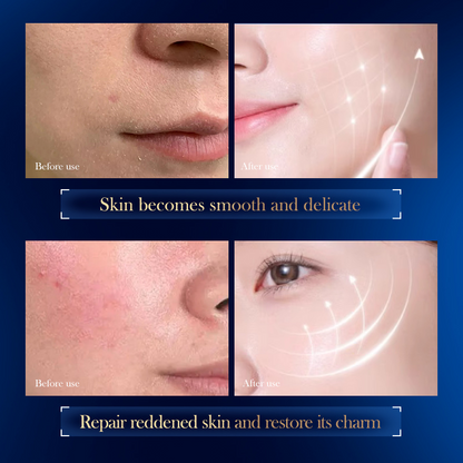 Hyaluronic Acid Sleeping Mask