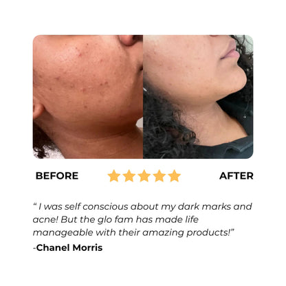 Turmeric Lemon Kojic Acid Soap