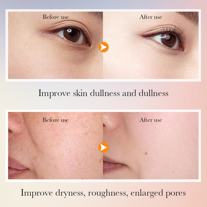 5x Vitamin C Whitening and Brightening Skin Care Gift Set