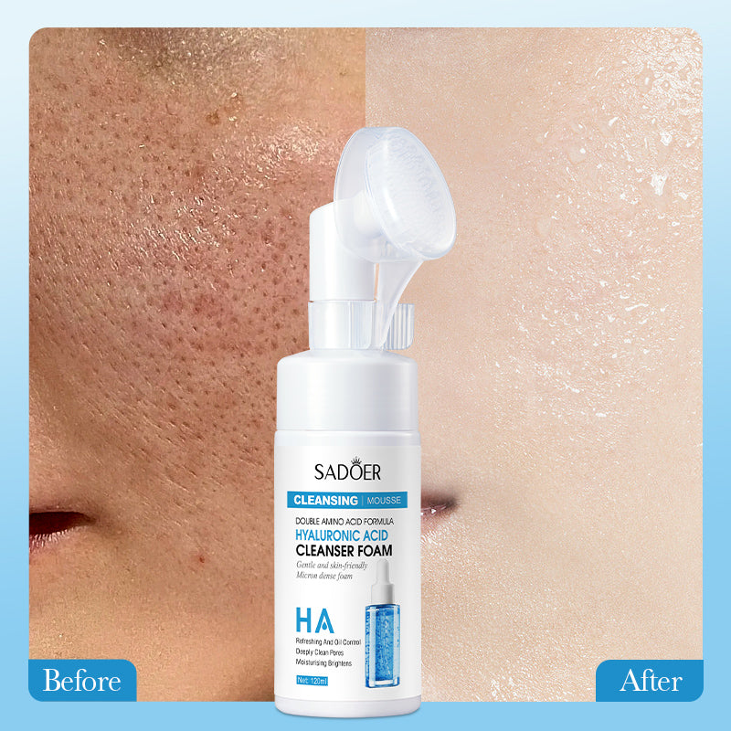 Hyaluronic Acid