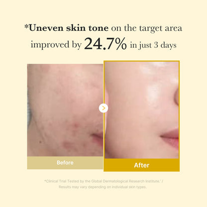 Alojalife-Kojic Acid Tumeric Overnight Peel Off Facial Mas-With free brush-Customer Feedback Images