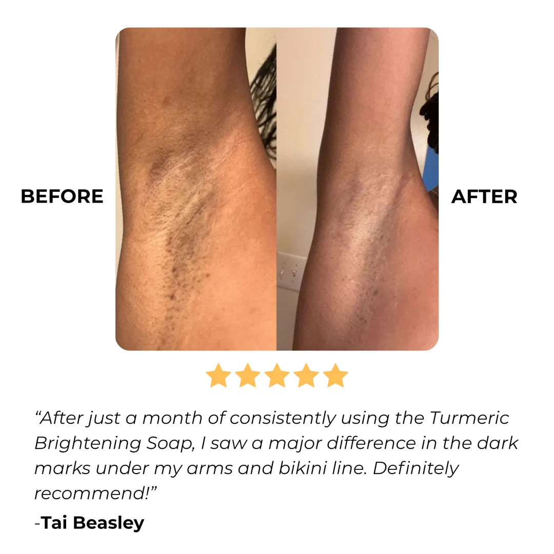 Alojalife-Turmeric Lemon Kojic Acid Soap-Yellow Colour-Customer Feedback Photos