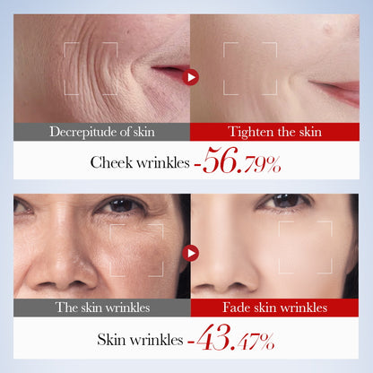 Snail Collagen Firming Anti-Wrinkle Gift Set