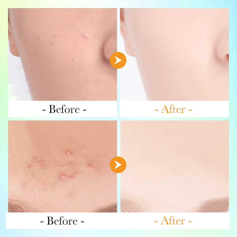 Vitamin C Salicylic Acid Cleansing Pads