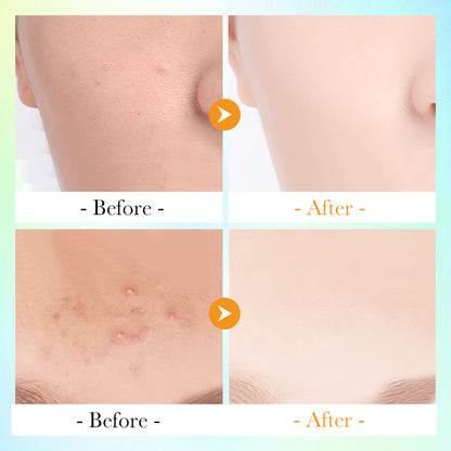 Vitamin C Salicylic Acid Cleansing Pads