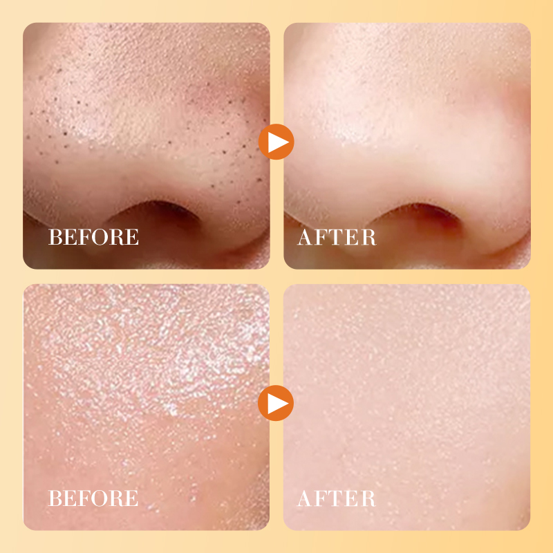 Vitamin C Skin Exfoliating Gel