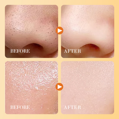 Vitamin C Skin Exfoliating Gel