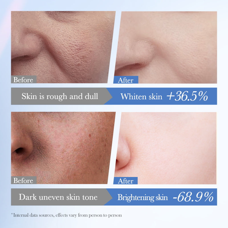 Alojalife White Rice Niacinamide Cream 1.8oz-Product Benefits
