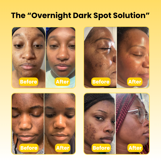 مناديل تنظيف البشرة بحمض الكوجيك والكركم (50 قطعة)